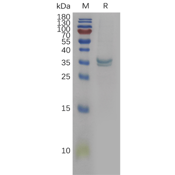 Human LDLR Protein蛋白, His Tag,