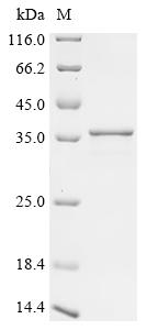 重组蛋白 Hepatitis delta virus gen