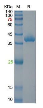 重组蛋白 ADV 5 E1A Protein蛋白, His,