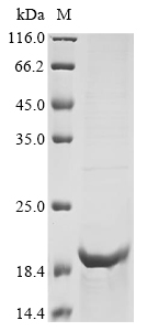 Human SLC30A8 Protein蛋白，orb147