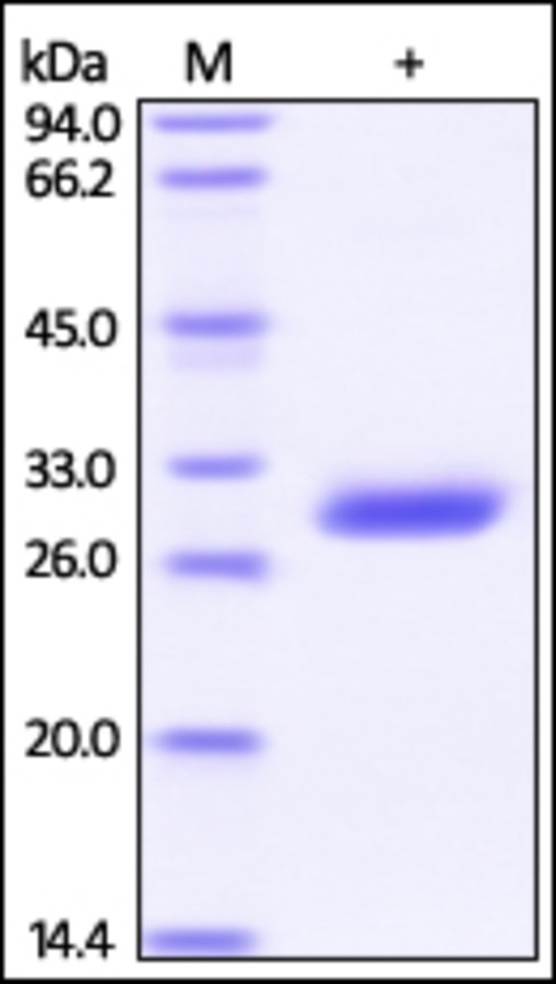 BTN3A3 重组蛋白，orb1228169，biorbyt