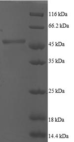 Human ARF5 Protein蛋白，orb245052