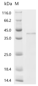 重组蛋白 Human metapneumovirus Maj