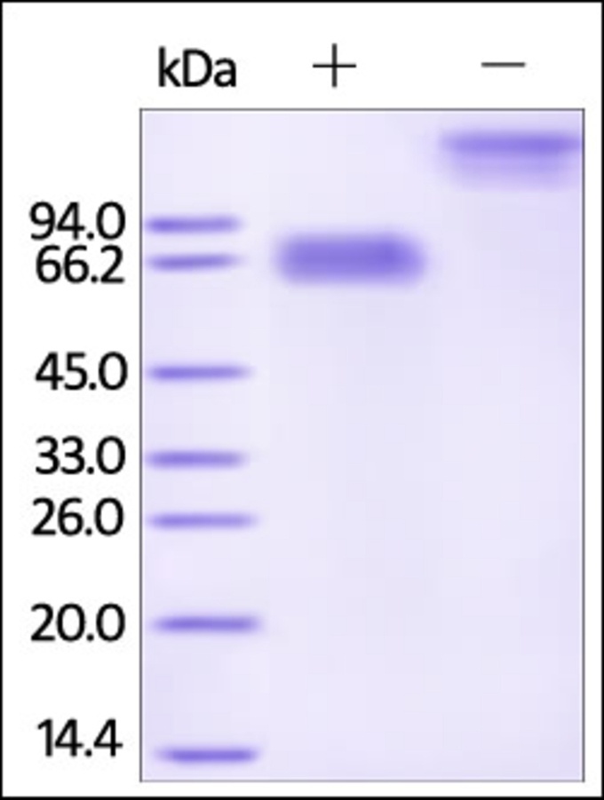 Mesothelin 重组蛋白，orb1227950，bio