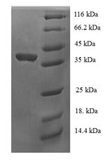 Human USF1 Protein蛋白，orb244619