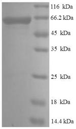 Human PAK4 Protein蛋白，orb244426