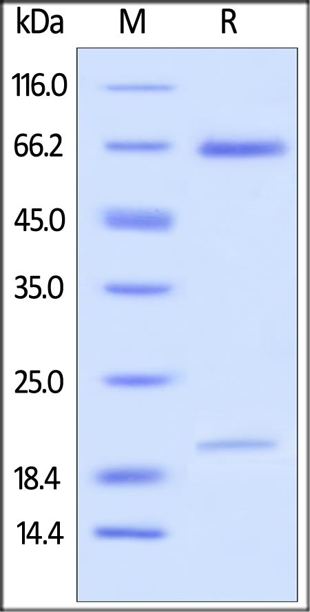 PCSK9 重组蛋白,orb1227931,biorbyt