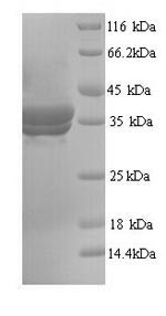 Yeast Annexin A5 Protein蛋白，orb