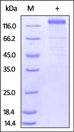 Cytomegalovirus Glycoprotein 重