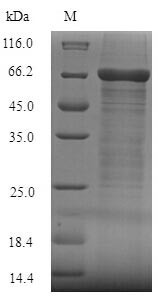 Human FCRL4 Protein蛋白，orb35841