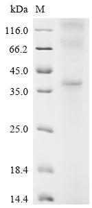 重组蛋白 Human Gastrin-releasing p