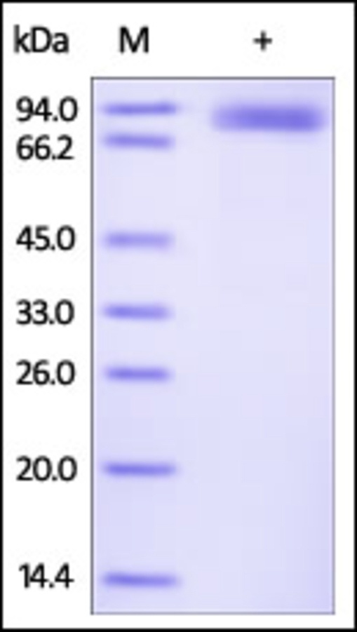 ROR 2 重组蛋白,orb1227897,biorbyt