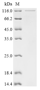 重组蛋白 Human Mitochondrial antiv