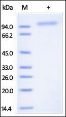 Human Cadherin-6 Protein蛋白, Hi