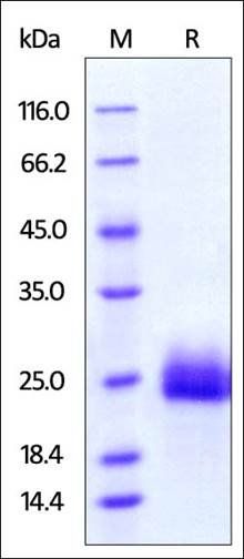 Human GITR Protein蛋白, His Tag，
