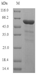Human INPP5A Protein蛋白，orb2448