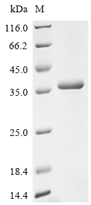 重组蛋白 Uncharacterized deoxyribo