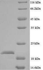 Yeast def Protein蛋白，orb245952，