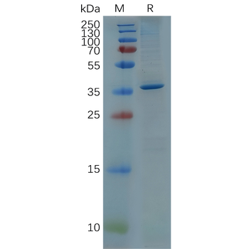 Human CTLA-4 Protein蛋白, mFc-Hi