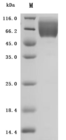 重组蛋白 Human Carcinoembryonic an