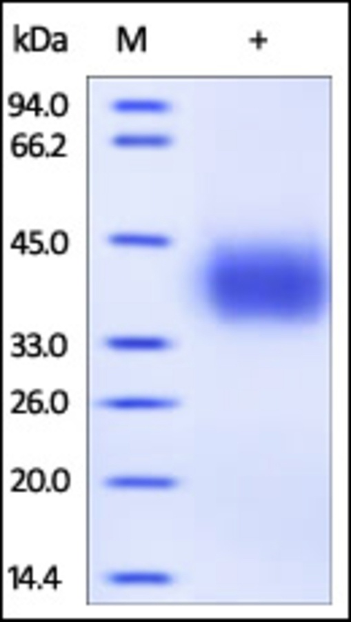 PDL1 重组蛋白，orb1227603，biorbyt