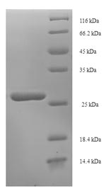 Rat Dac g 3 Protein蛋白，orb35813
