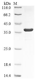 重组蛋白 Human Intelectin-1 (ITLN1