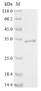 重组蛋白 Coxiella burnetii Unchara