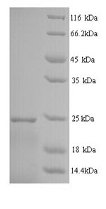Human IFNA14 Protein蛋白，orb2458