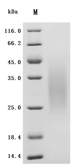 重组蛋白 Human B-cell antigen rece