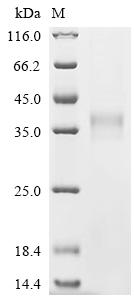 重组蛋白 Human Butyrophilin-like P