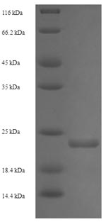 E.coli stxB2 Protein蛋白，orb2462