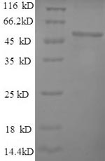 Human RPL15 Protein蛋白，orb24512