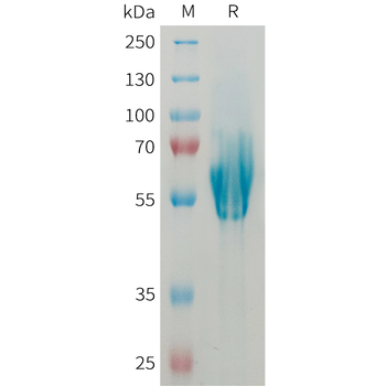 Human CEACAM5(233-322) Protein