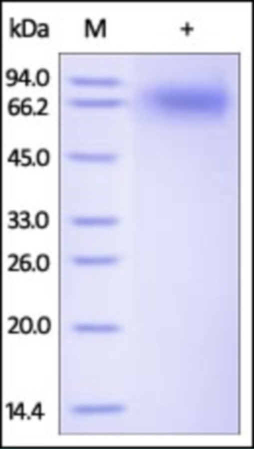 NTRK2 重组蛋白，orb1227938，biorbyt
