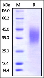 BTLA 重组蛋白，orb1227700，biorbyt