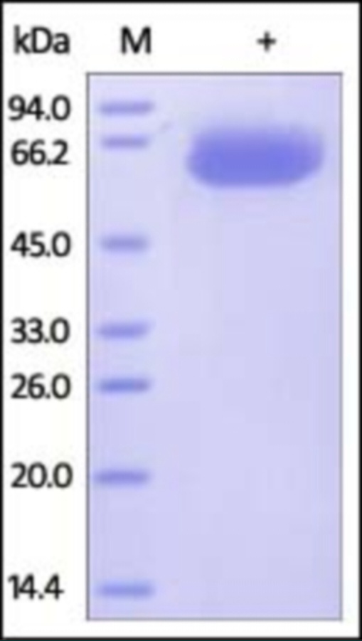 PDL1 重组蛋白，orb1227920，biorbyt