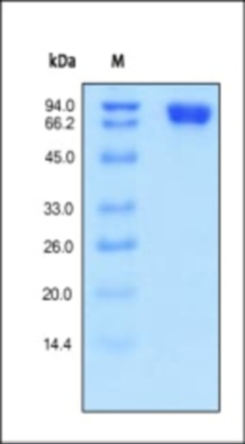 MCAM 重组蛋白，orb1228137，biorbyt