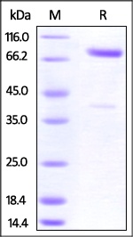 CRTAM 重组蛋白,orb1227814,biorbyt