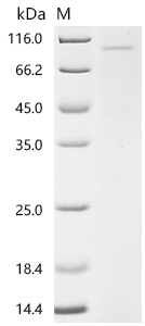 重组蛋白 Human Importin subunit be
