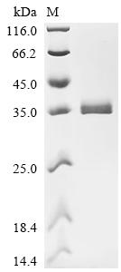 重组蛋白 Human Ubiquitin-conjugati
