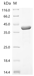 重组蛋白 Epstein-Barr virus Envelo