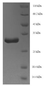 Bacterial acpS Protein蛋白,orb35