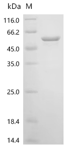 重组蛋白 Human Casein kinase I iso