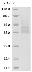 重组蛋白 Human Poly [ADP-ribose] p