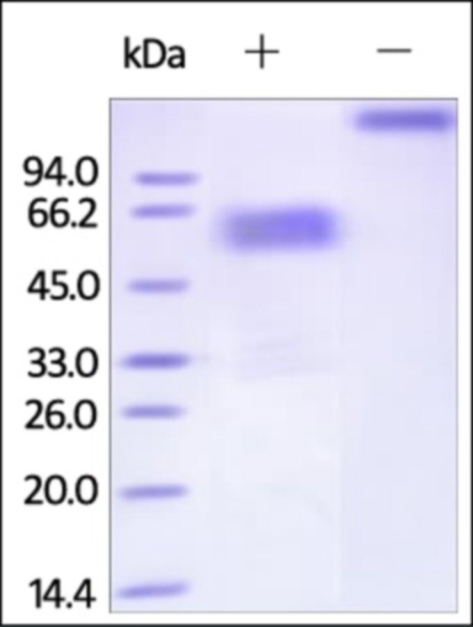 TIM3 重组蛋白，orb1227859，biorbyt