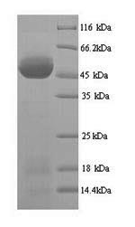 Yeast AC1 Protein蛋白，orb246819，