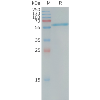 Human CD33(18-259) Protein蛋白,