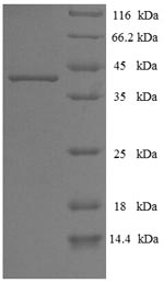 E.coli BALF5 Protein蛋白，orb2447