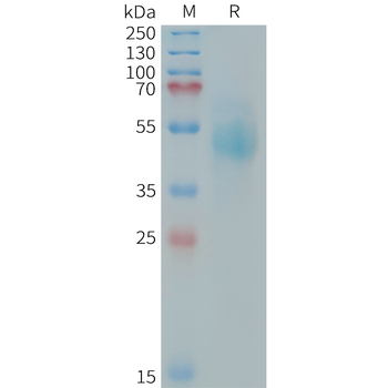 Human CDH3(216-328) Protein蛋白,